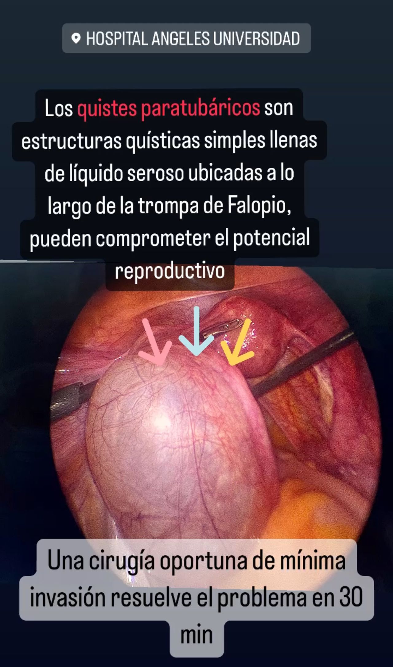 Griselda Reyes Torres-52