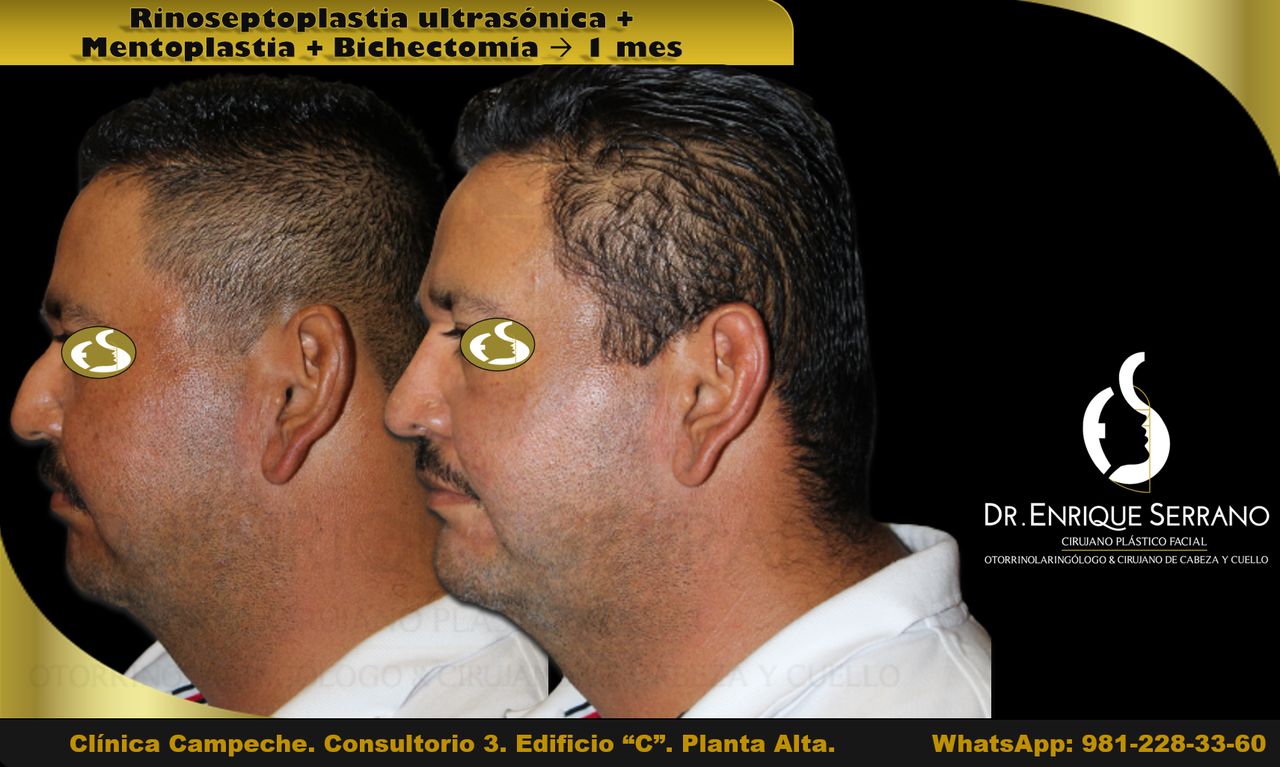 Enrique Serrano Cruz-26