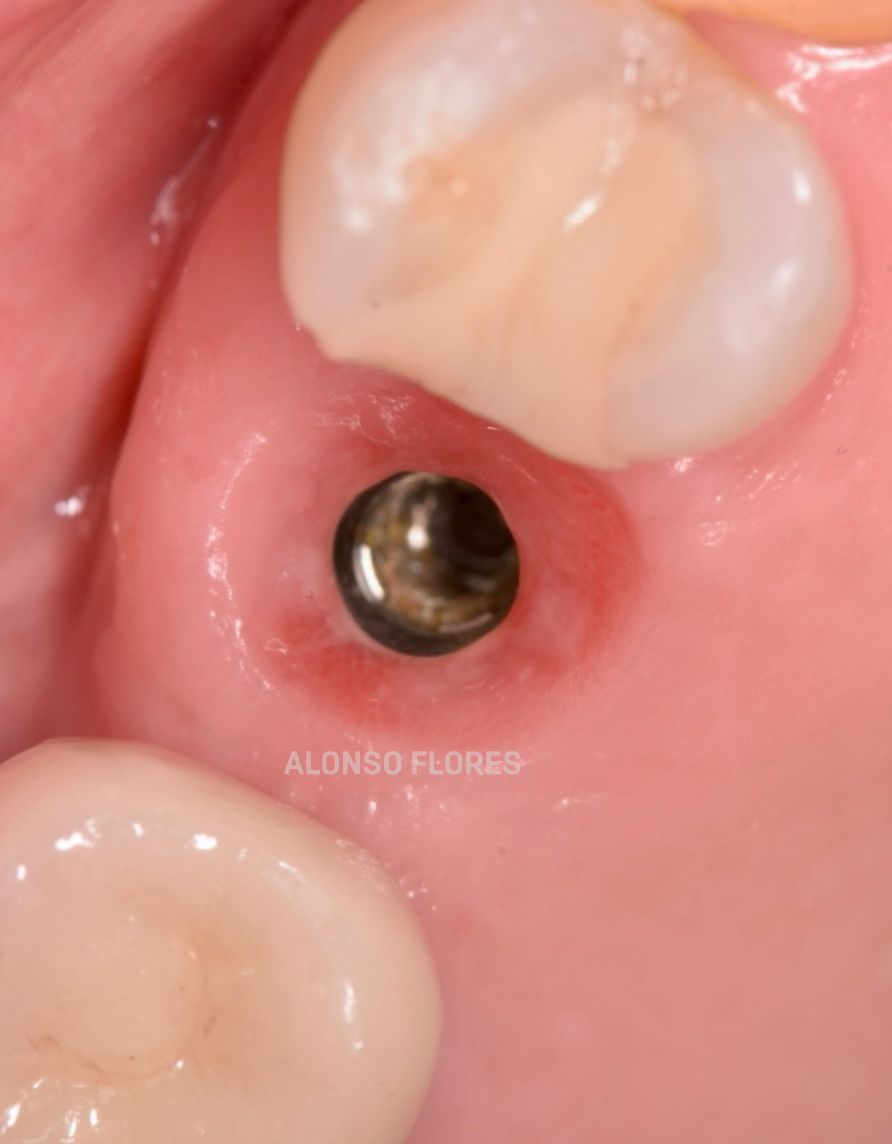 Luis Alonso Flores Reyna-3