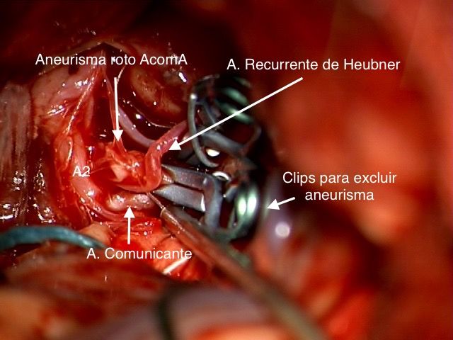 Celia Teresa De Jesús Álvarez Gamiño-32