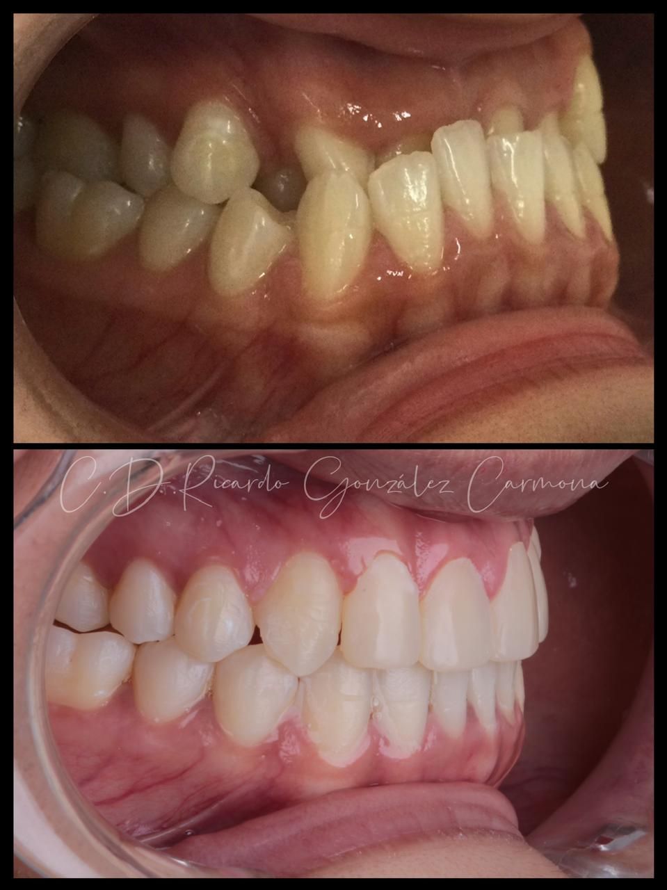 Alicia Carmona López-10