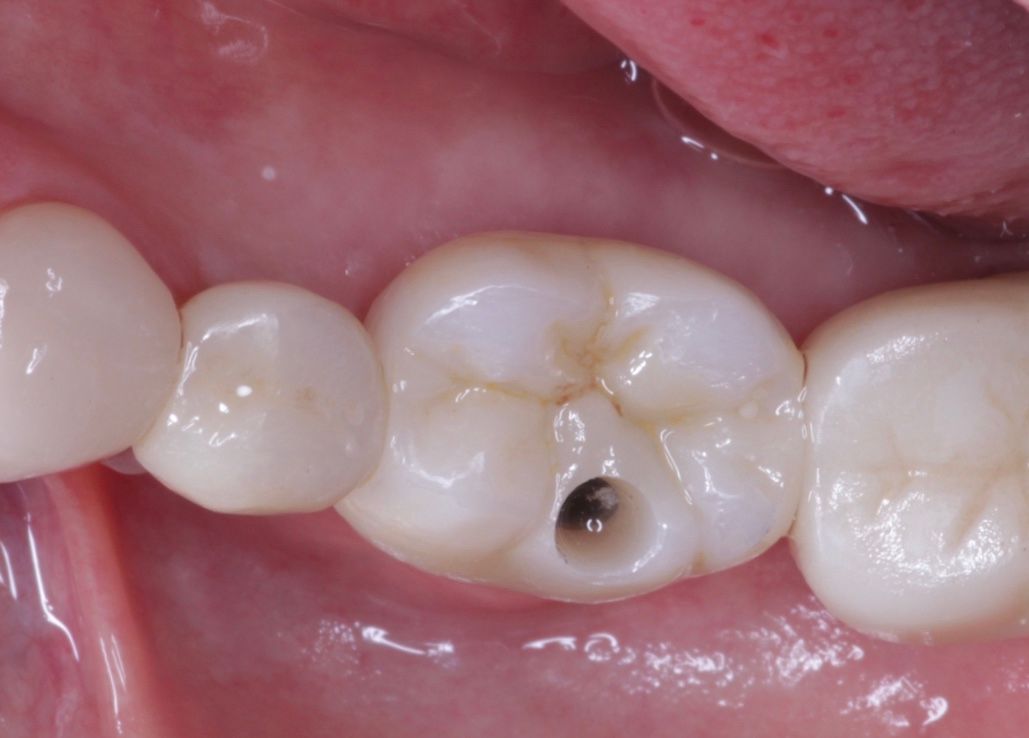 Josué Márquez Gómez-78