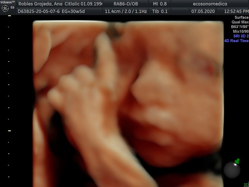 Héctor Bernardo Acevedo Manrique-12