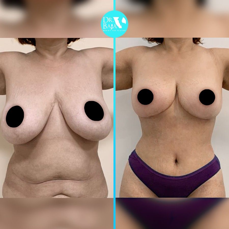 Renato Rodríguez Hirales-29