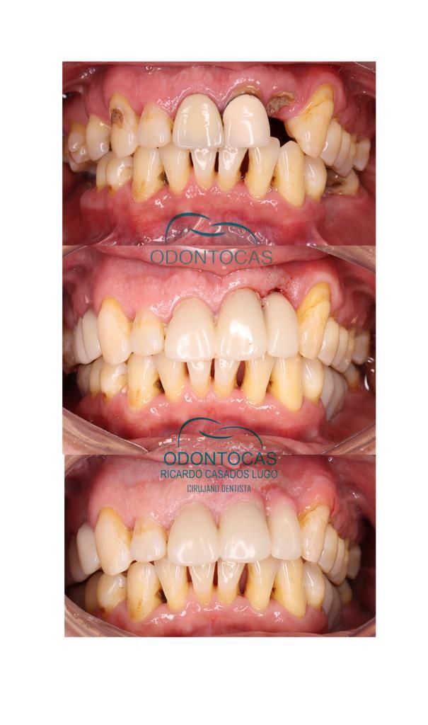 Ricardo Casados Lugo-8