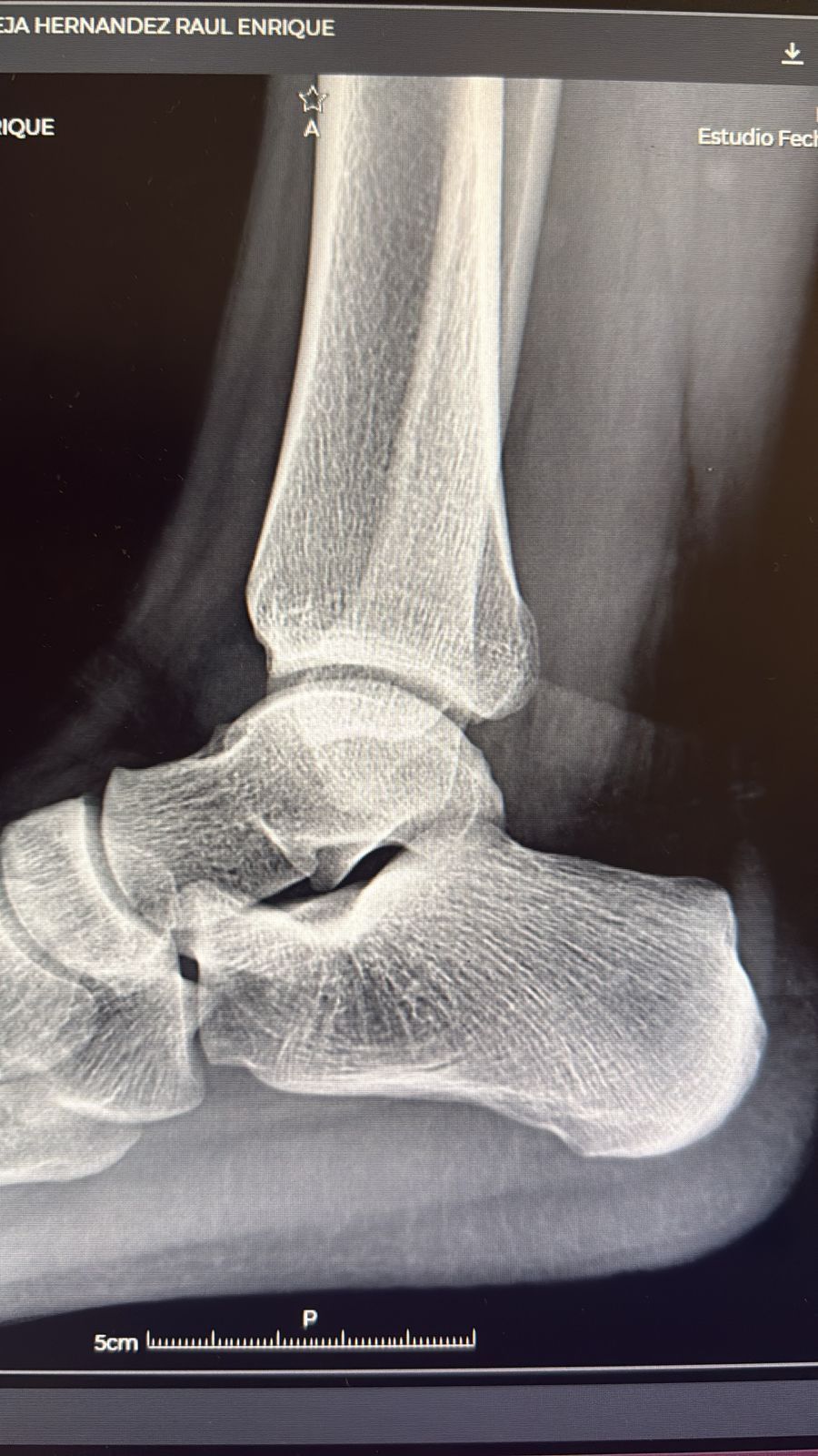 Alejandro Irisson-18