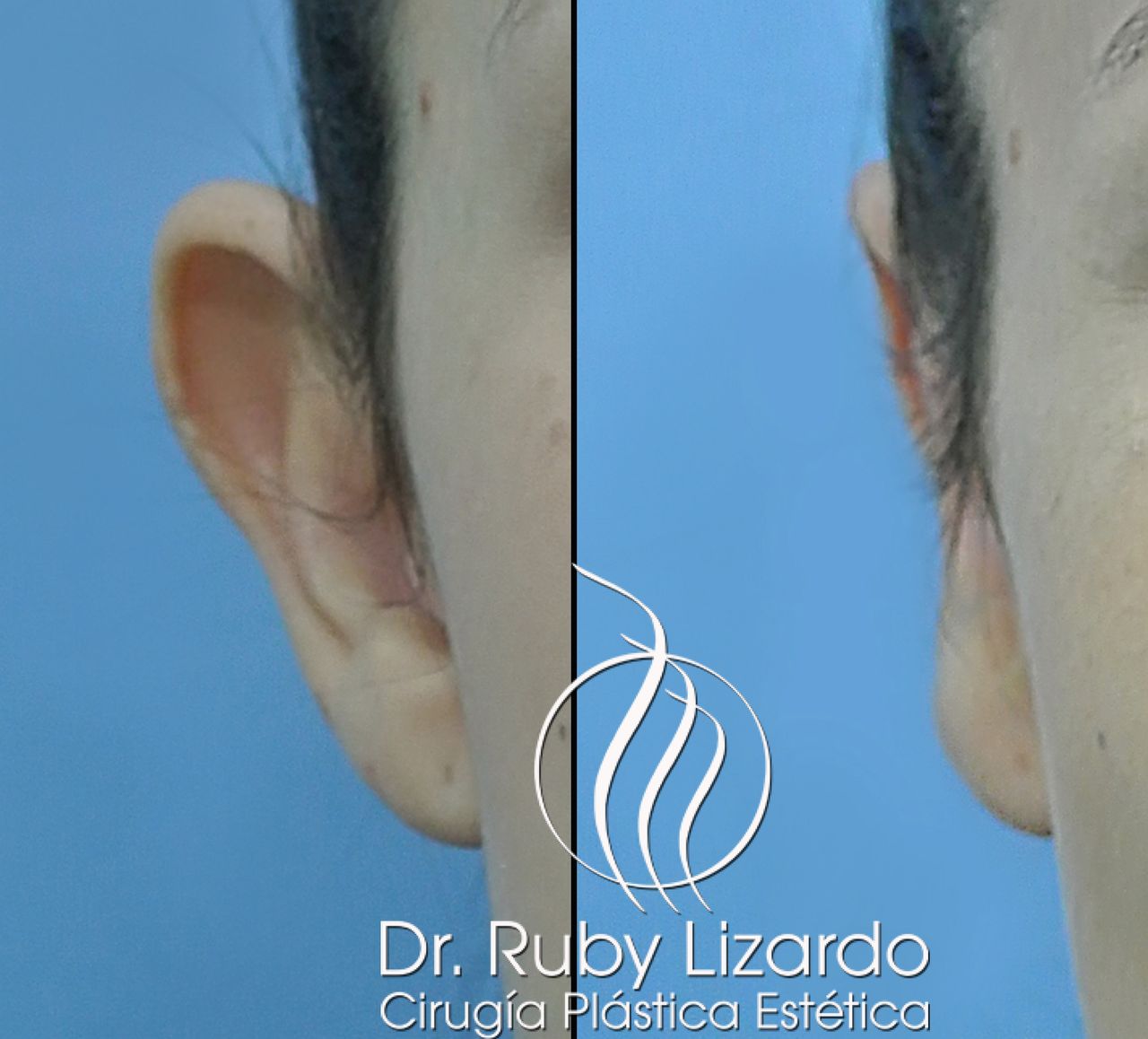 Ruby Lizardo Ramírez Robles-9