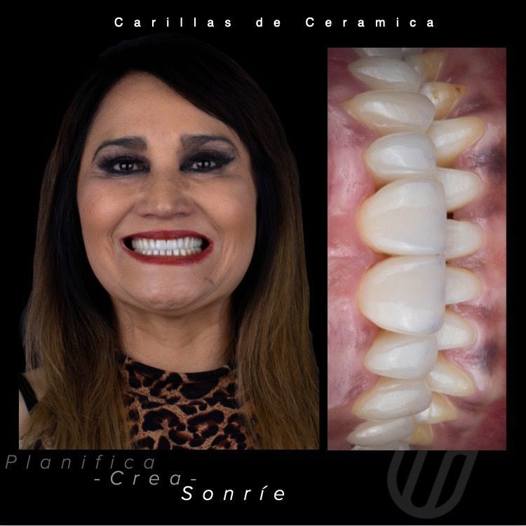Alejandra Esparza Flores-19