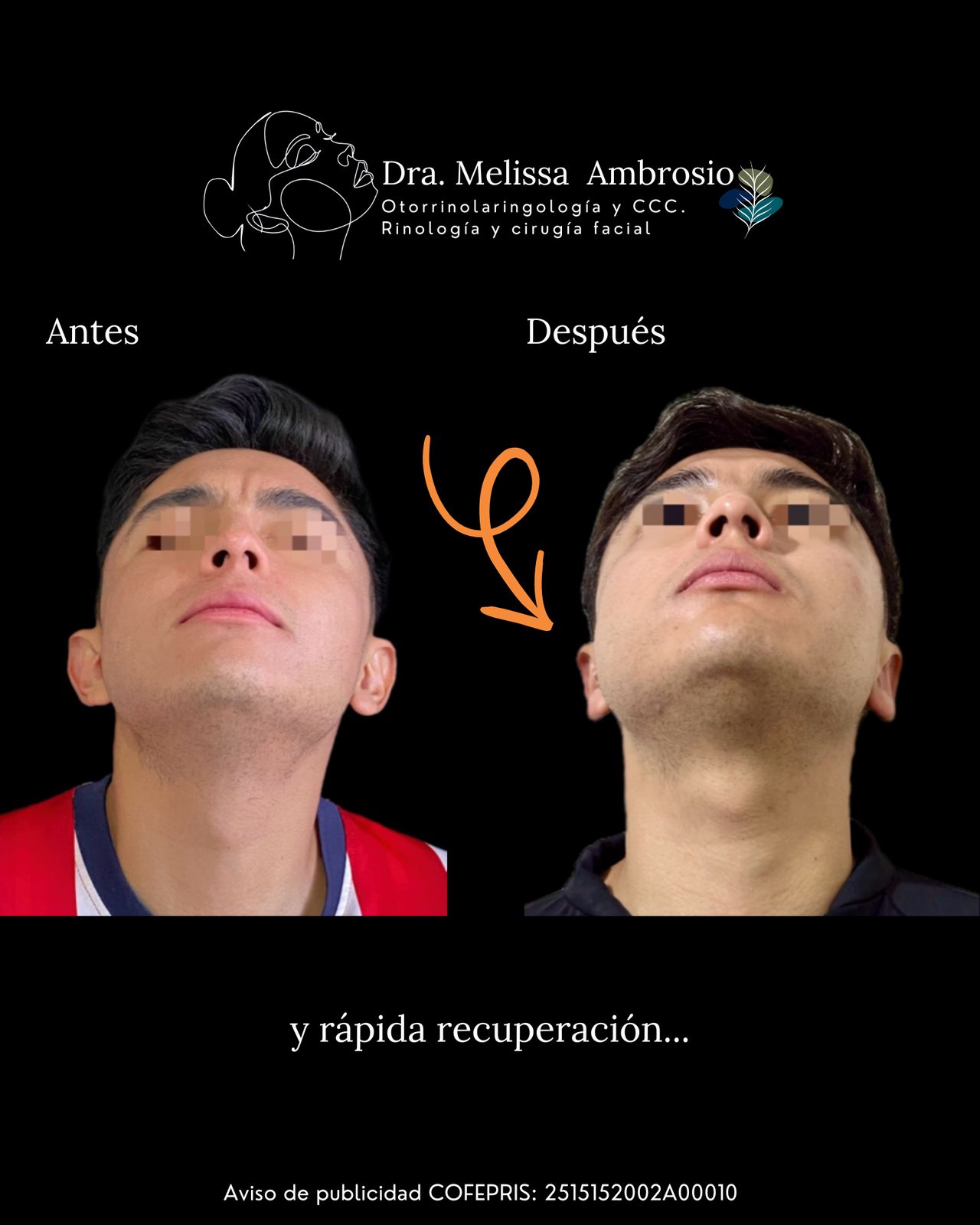 Melissa Guadalupe Ambrosio Mendoza-21