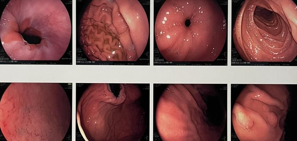 Luis Alberto Revuelta Rodriguez-3