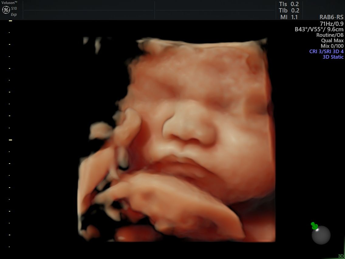 Arturo Herrera Flores-7