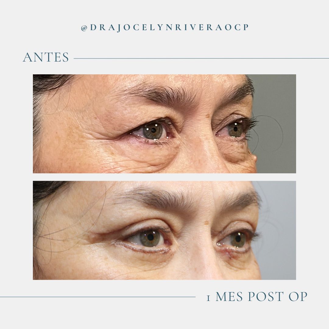 Ivonne Jocelyn Rivera Alvarado-2