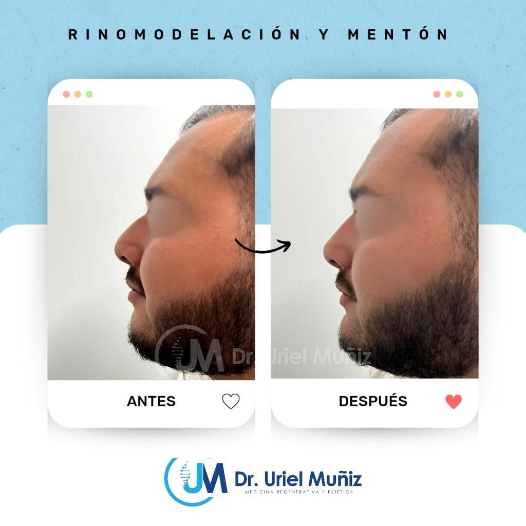 Teófilo Uriel Muñiz Chávez-24