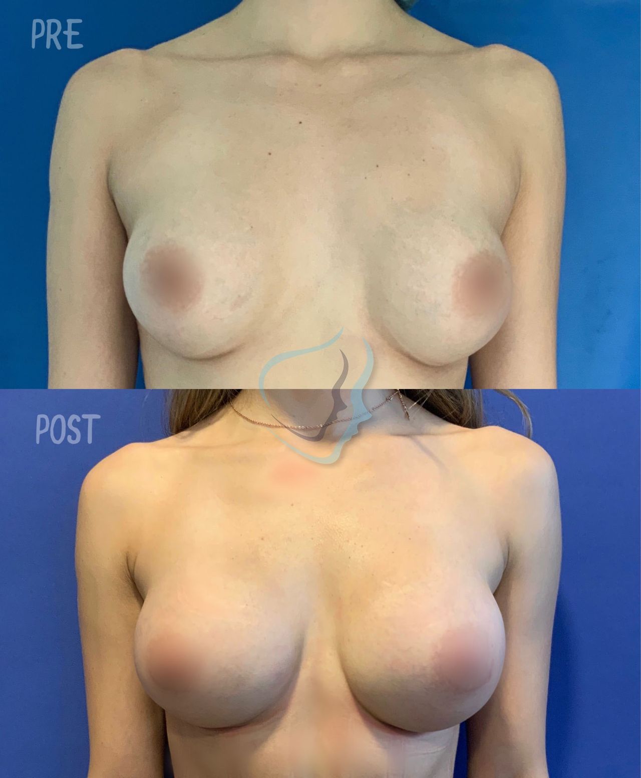 Giuseppe Tanzillo-49