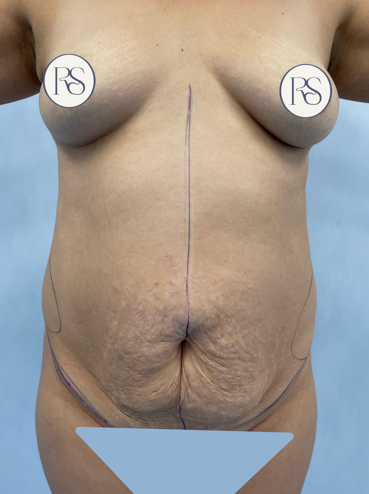 Ricardo Sánchez Mata-0