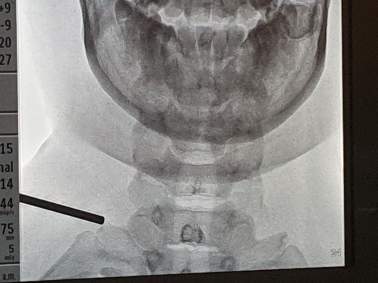 Gerardo Solís Valadéz-0