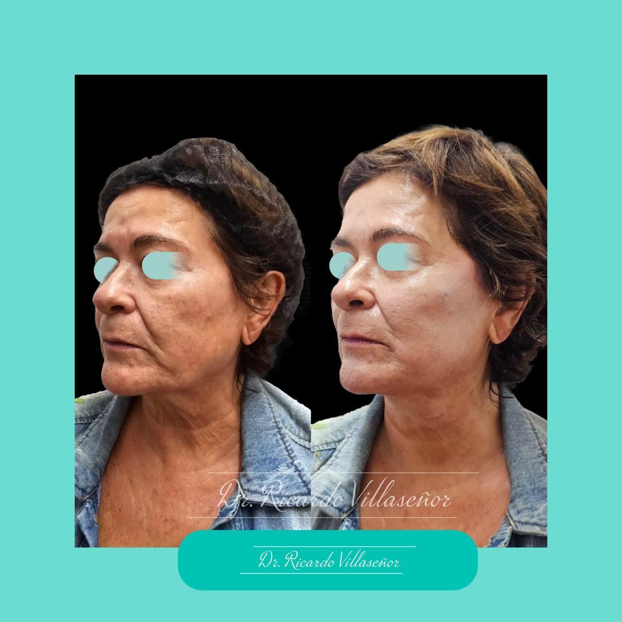 Ricardo Villaseñor Dominguez-1