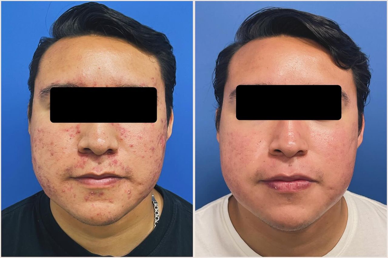 Adrián Martínez Moreno-6