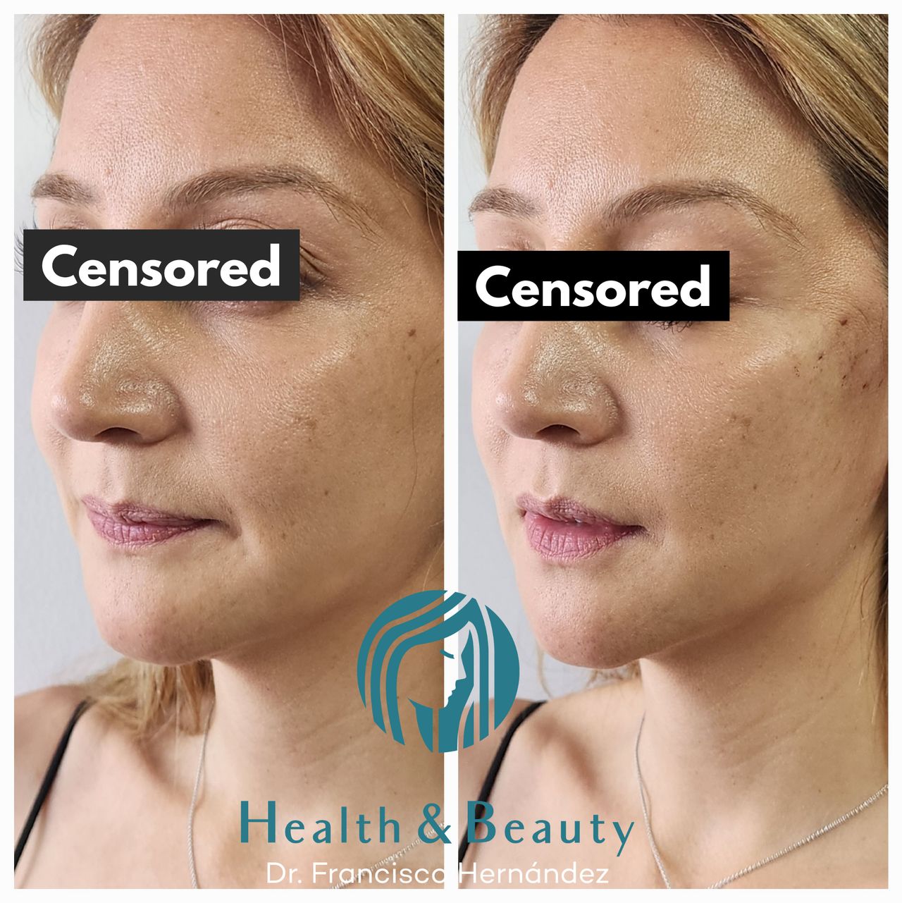 Francisco Hernández Gómez Crespo-32