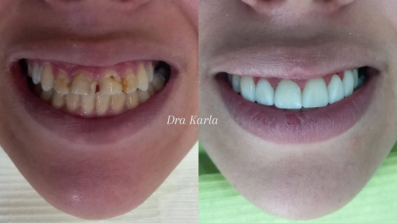 Karla I. Martinez Sosa-13