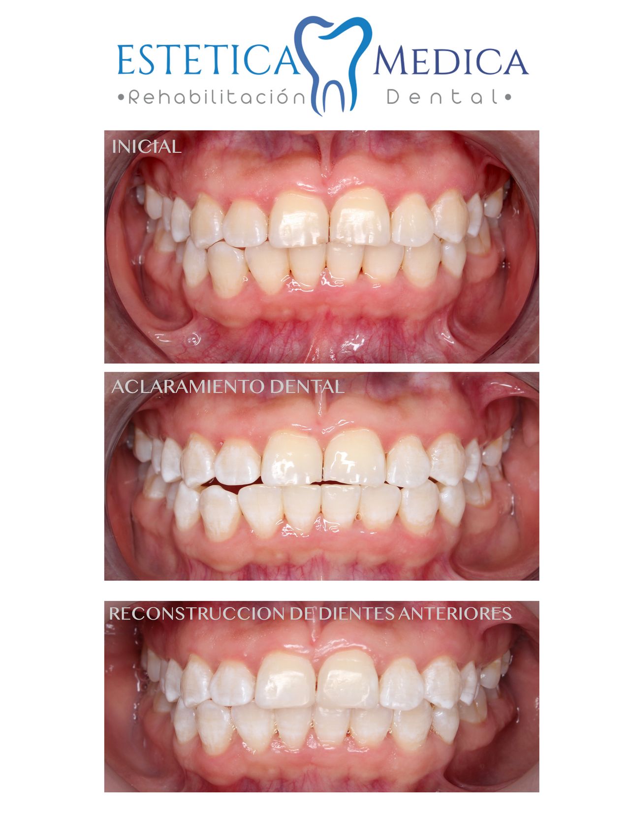 Bielmy Veronica Jonapa Peña-18