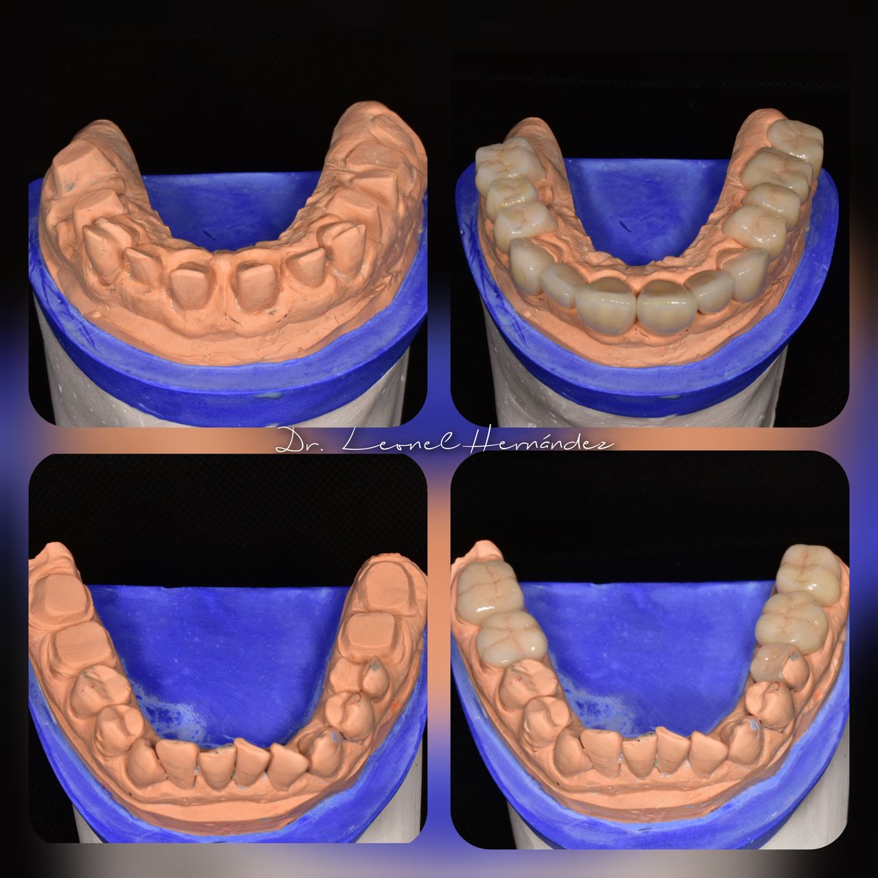 Leonel Hernández Gómez-15