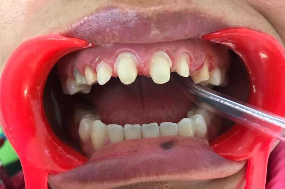 Martha Grissel Alcantar Camacho-11