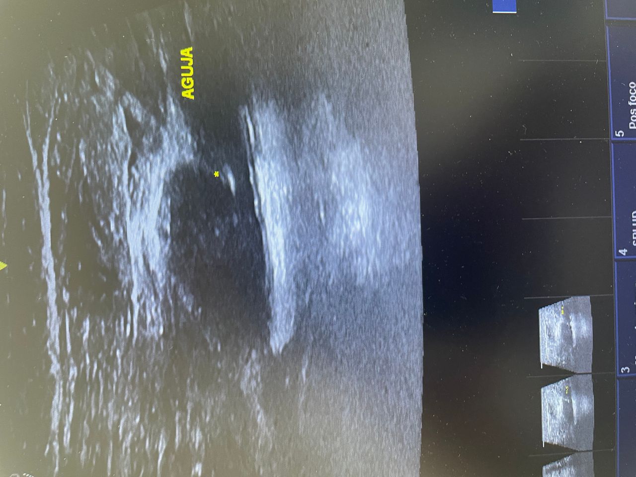 José Ismael Pineda Pérez-2