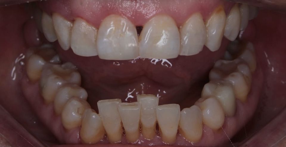 Carlos Enrique Hernández Rodríguez-13