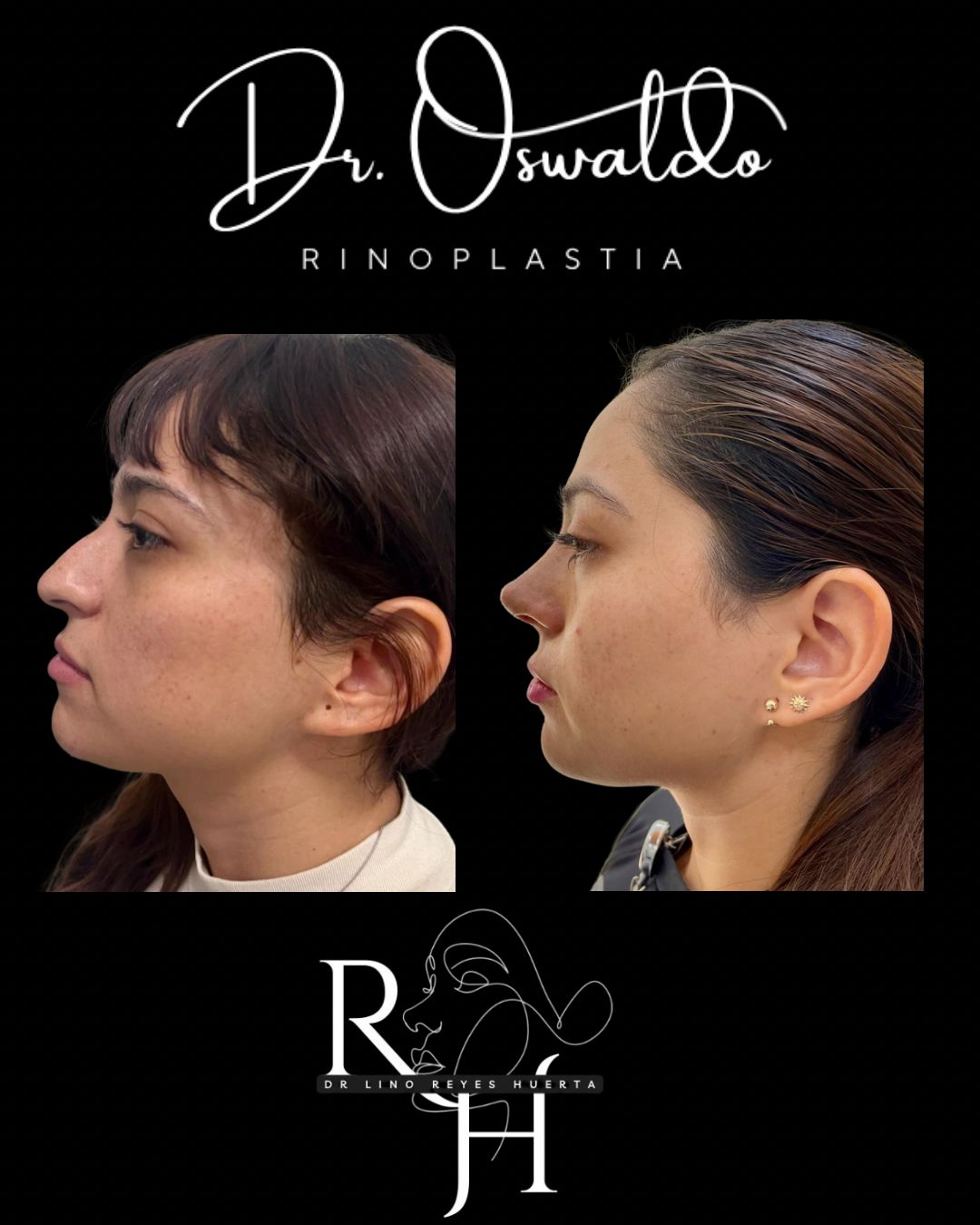 Lino Oswaldo Reyes Huerta-1