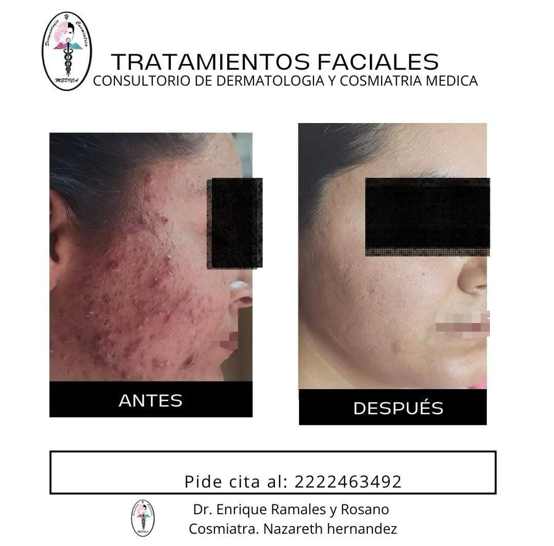 Enrique Ramales Rosano-10