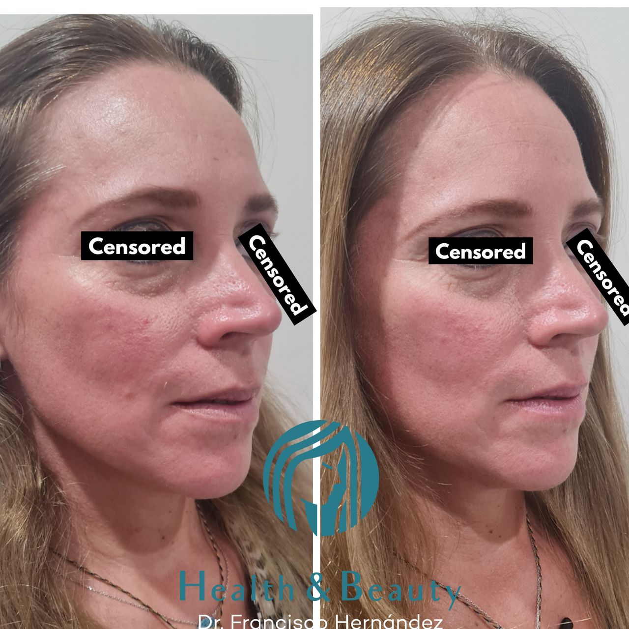 Francisco Hernández Gómez Crespo-85