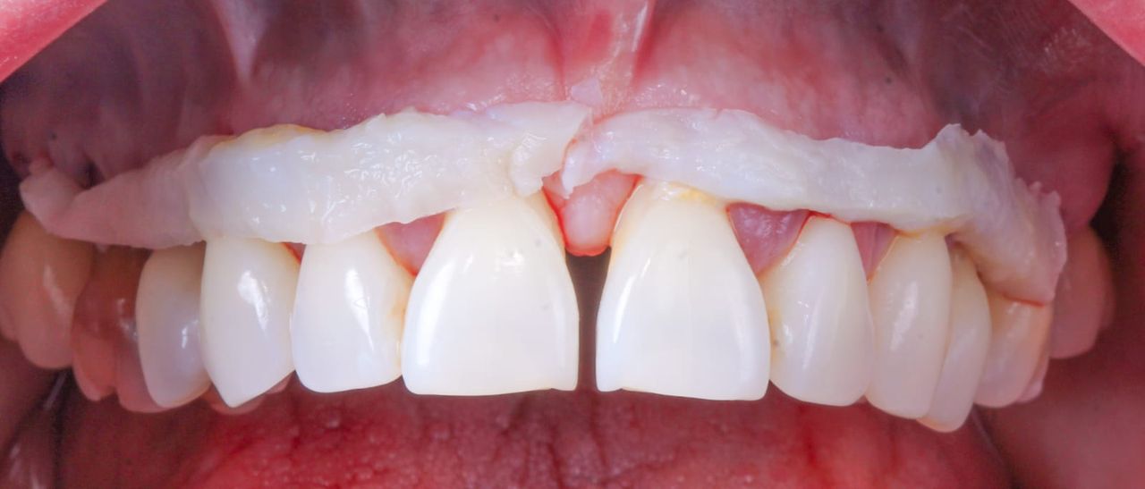 Hugo Enrique Aguilar Lamas-21