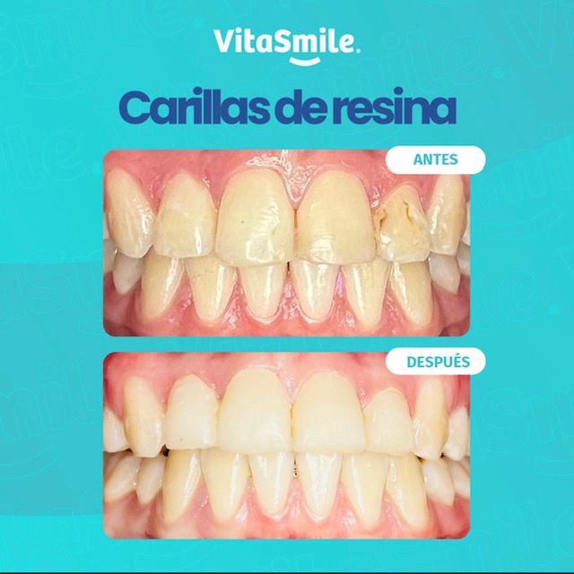 Genesis Johanna Cazares Valles-1