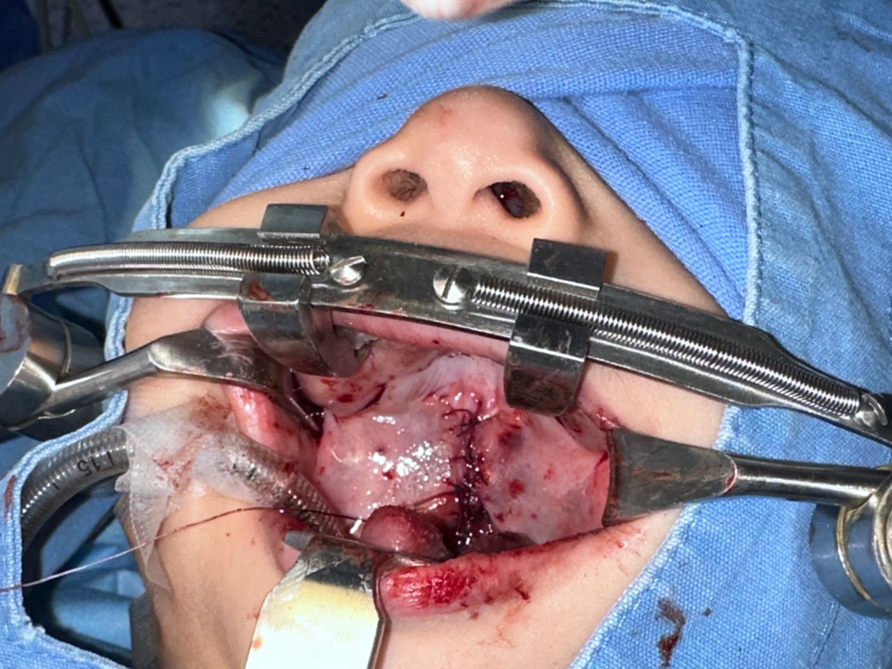 Erendalhi Rocha Mesta-2