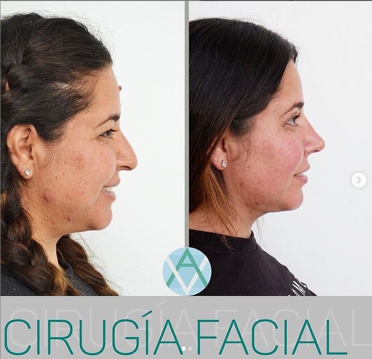 Alfonso Villaseñor Herrero-0