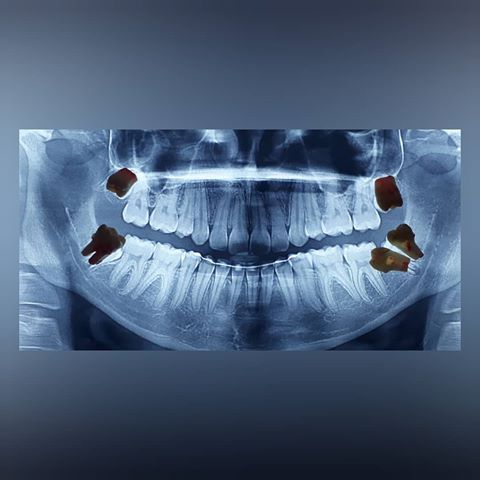 Rubén Ascencio Padilla-4