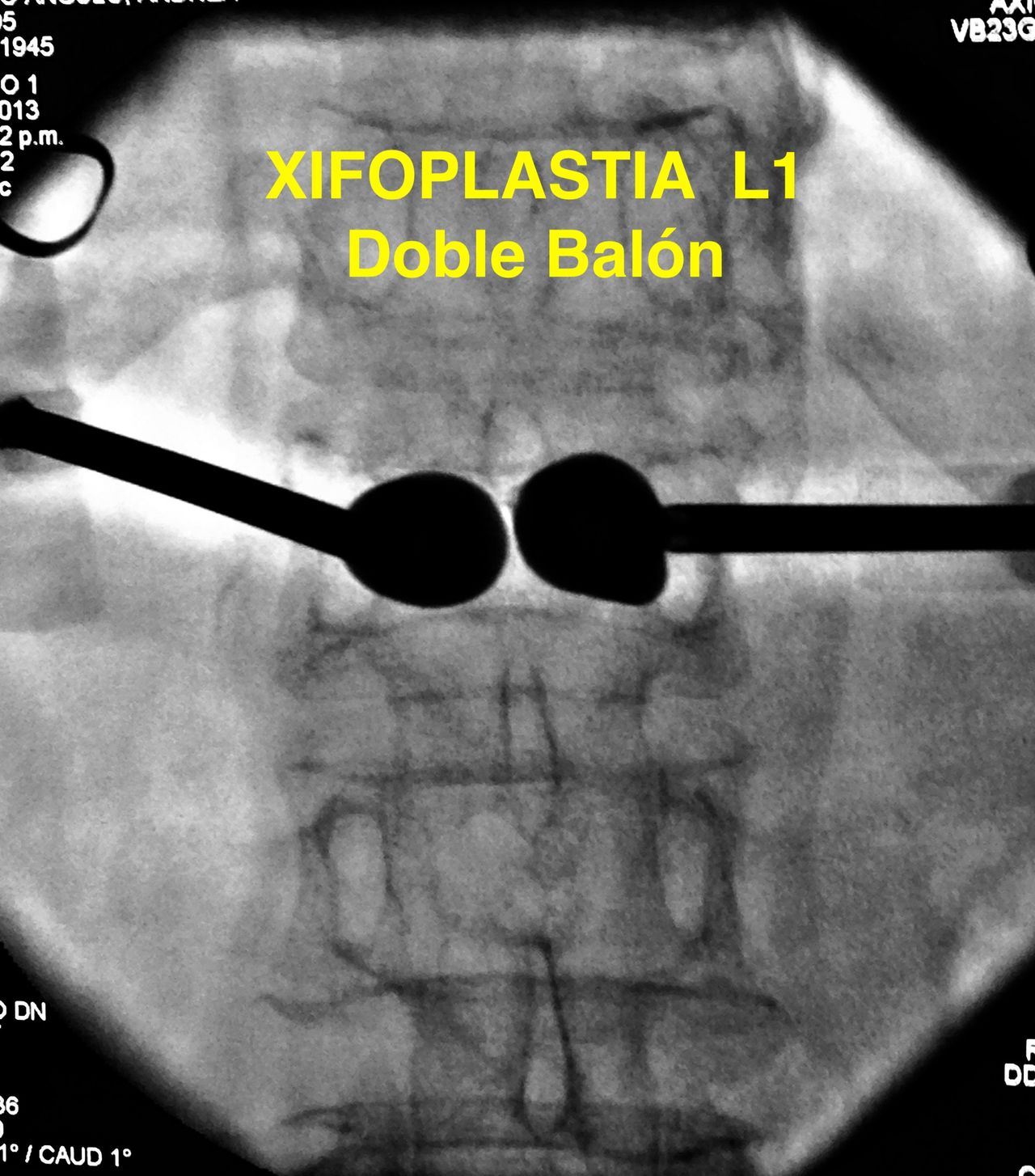 Jesus Rocha Maguey-21