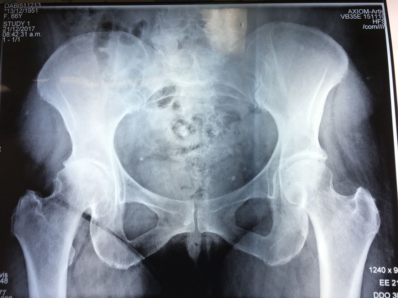 Alberto Viñas Silva-7