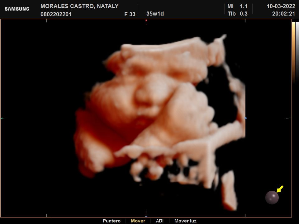 Alejandro Morales Delgado-3