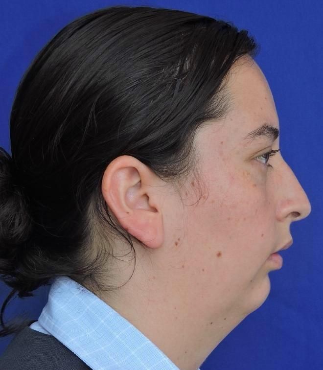 Alberto Wintergerst Fisch-33