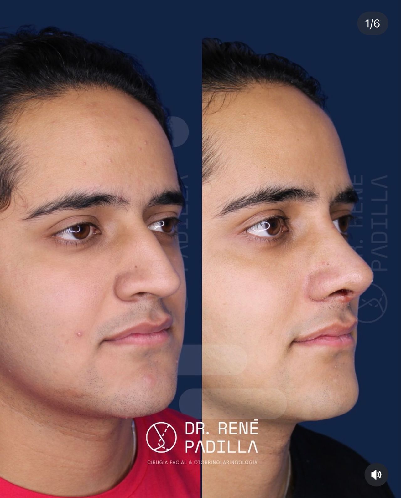 René Emmanuel Padilla López-14