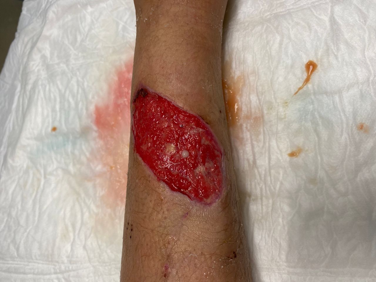 Susana Contreras Reyes-11