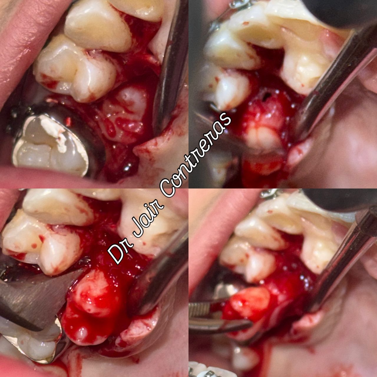 Jair Contreras García-59