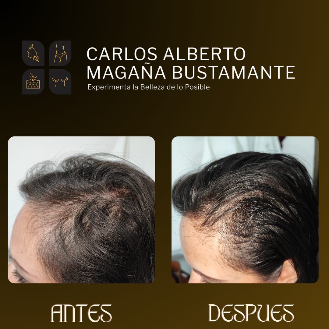 Carlos Alberto Magaña Bustamante-16