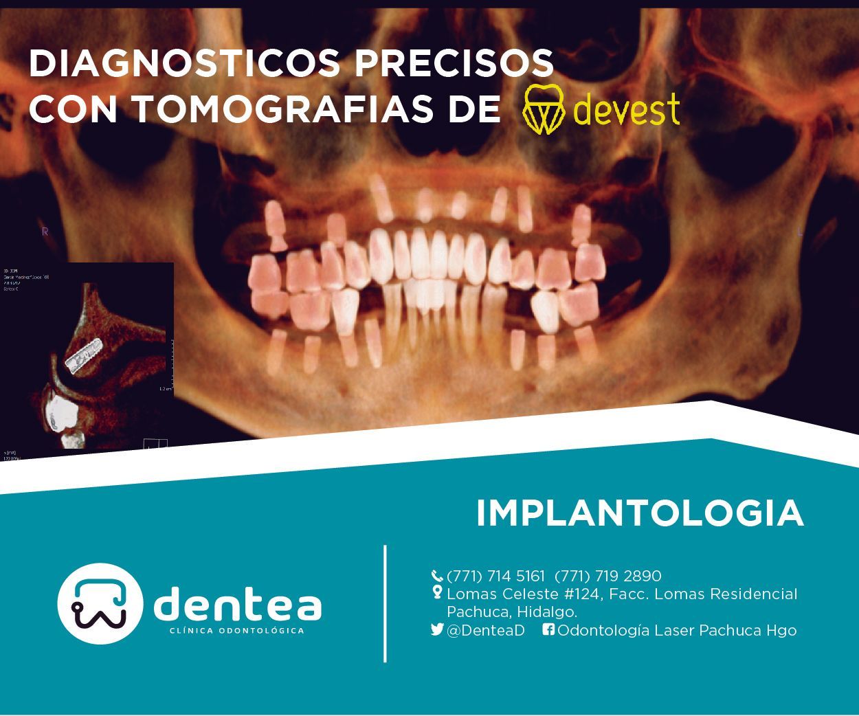 Iracema Linares Sánchez-13