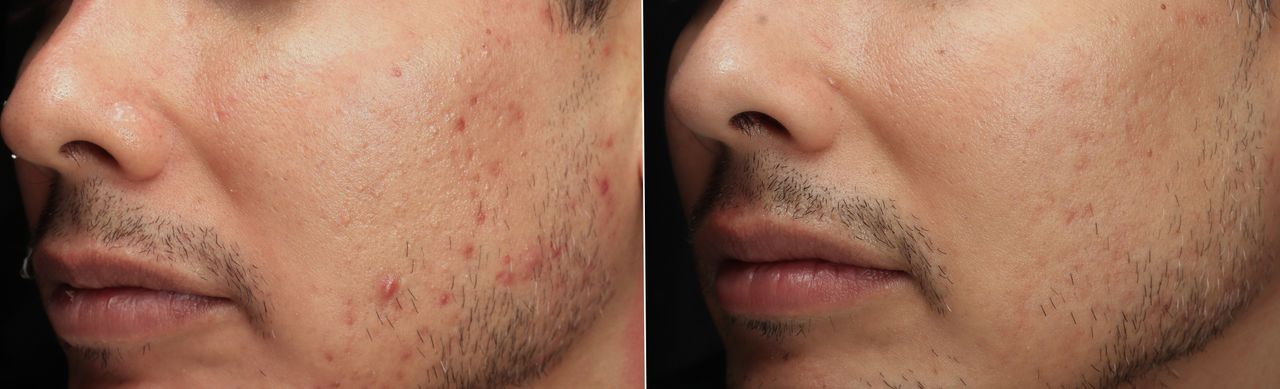 Lauro Francisco Varela Coronado-3