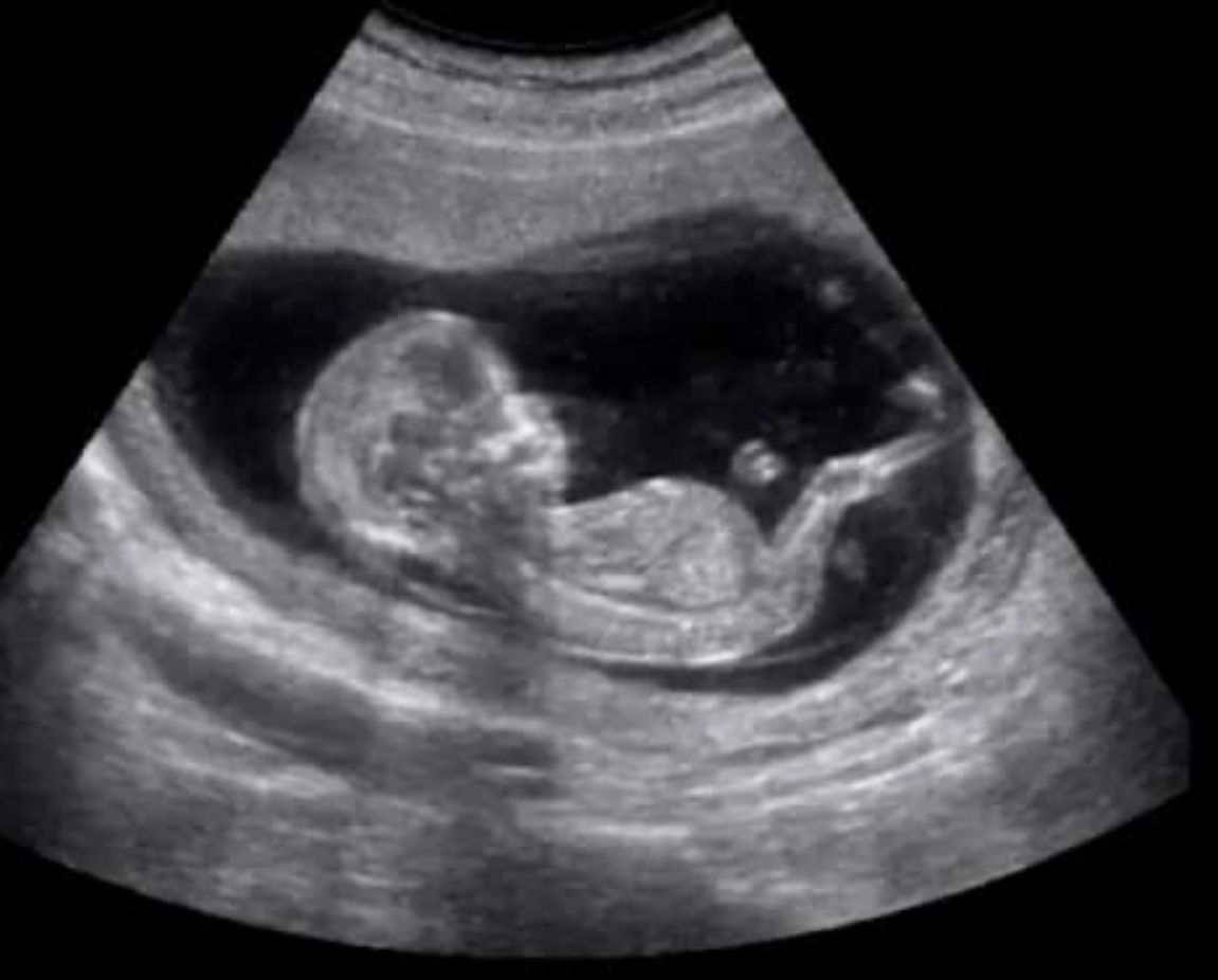 María Teresa Flores Molina-1