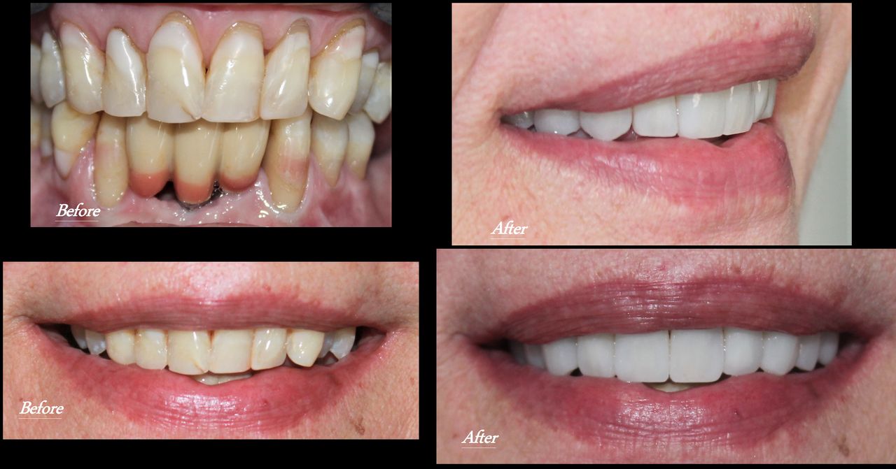 Aimee Valles Monárrez-36