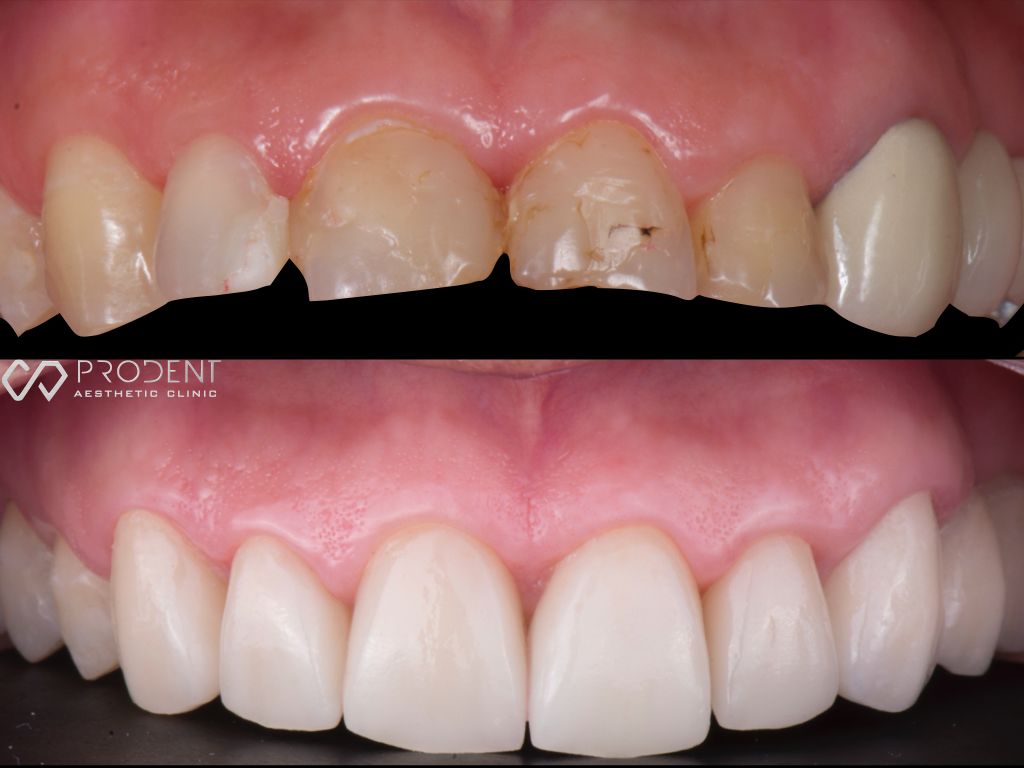 Ulises Pérez Murillo-47